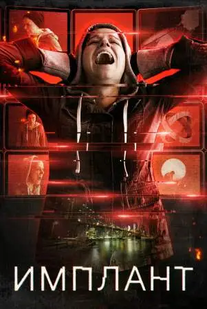 Имплант онлайн
